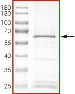 Sino Biological&nbsp;Recombinant Human UHMK1/KIS Protein (Full Length, GST Tag)